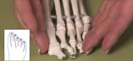 Dedos deformados calzado
